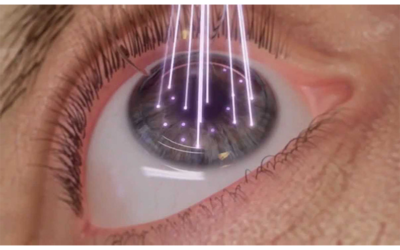 Robot-assisted Eye Examination