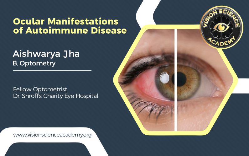 Ocular Manifestations of Autoimmune Disease