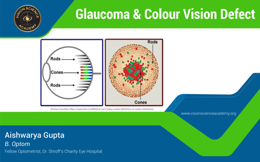 & Colour Vision Defect Vision Science Academy
