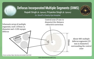 Defocus Incorporated Multiple Segments (DIMS)