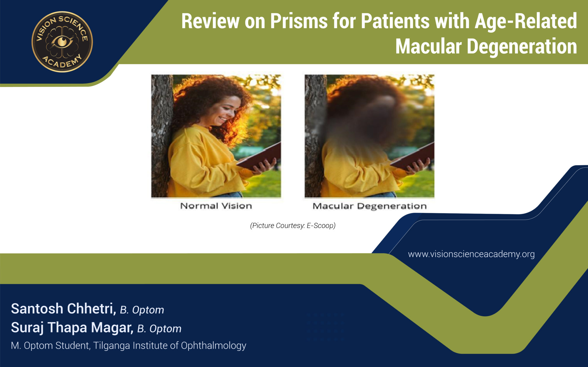 Review on Prisms for Patients with AgeRelated Macular Degeneration