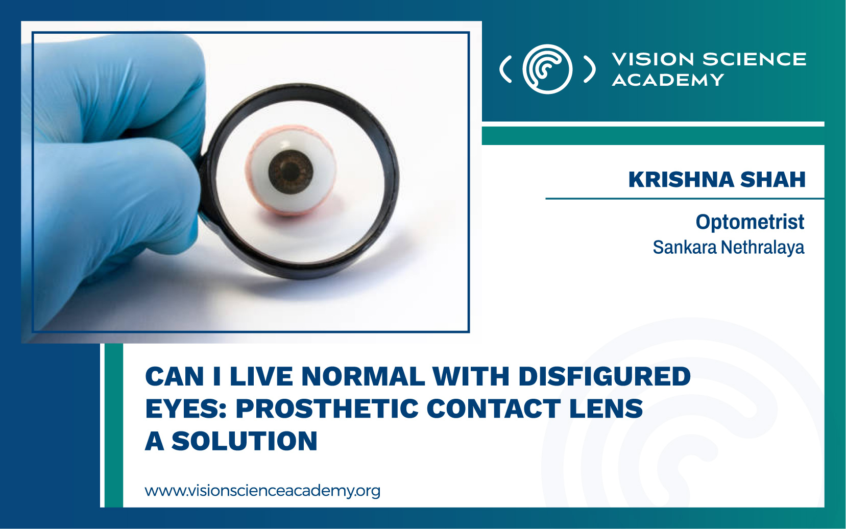 Can I Live Normal With Disfigured Eyes Prosthetic Contact Lens A