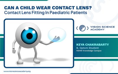 Can A Child Wear Contact Lens? – Contact Lens Fitting In Paediatric Patients