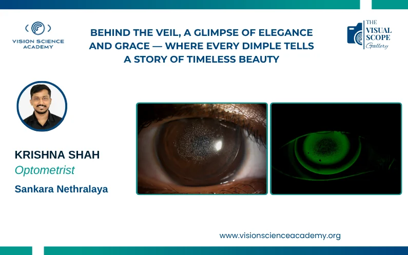 Behind the veil, a glimpse of elegance and grace — where every dimple tells a story of timeless beauty