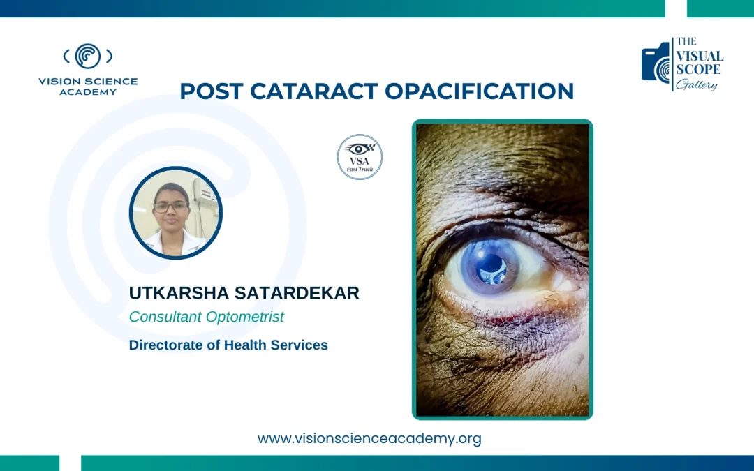 Post Cataract Opacification