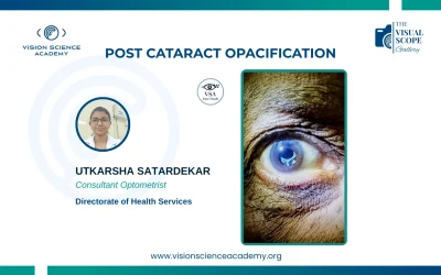 Post Cataract Opacification