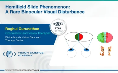 Hemifield Slide Phenomenon: A Rare Binocular Visual Disturbance