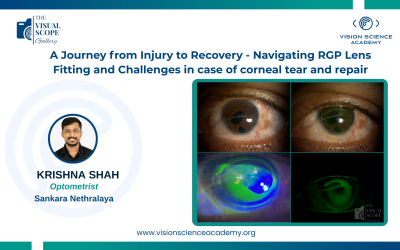 A Journey from Injury to Recovery – Navigating RGP Lens Fitting and Challenges in Case of Corneal Tear and Repair