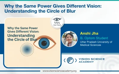 Why the Same Power Gives Different Vision: Understanding the Circle of Blur