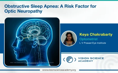 Obstructive Sleep Apnea: A Risk Factor for Optic Neuropathy