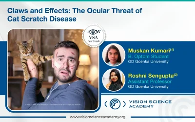 Claws and Effects: The Ocular Threat of Cat Scratch Disease