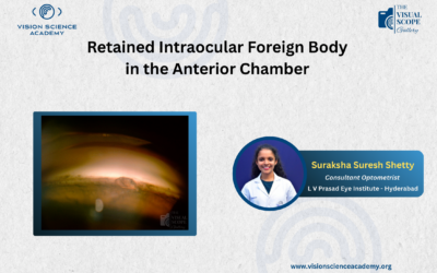 Retained Intraocular Foreign Body in the Anterior Chamber