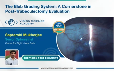 The Bleb Grading System: A Cornerstone in Post-Trabeculectomy Evaluation