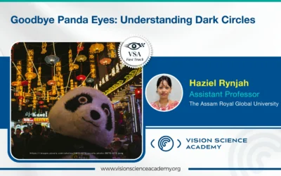 Goodbye Panda Eyes: Understanding Dark Circles