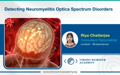 Detecting Neuromyelitis Optica Spectrum Disorders