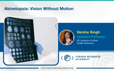 Akinetopsia: Vision Without Motion