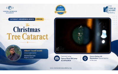 The Christmas Tree Cataract