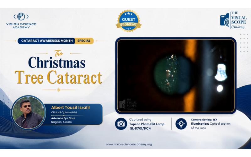 The Christmas Tree Cataract