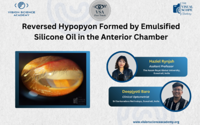 Reversed Hypopyon Formed by Emulsified Silicone Oil in the Anterior Chamber