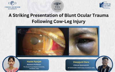 A Striking Presentation of Blunt Ocular Trauma Following Cow-Leg Injury