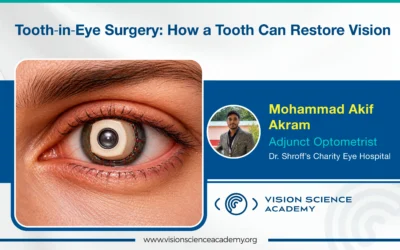 “Tooth‐in‐Eye” Surgery: How a Tooth Can Restore Vision