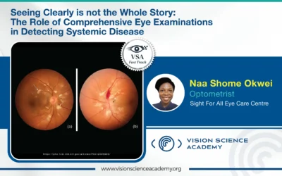 Seeing Clearly is not the Whole Story: The Role of Comprehensive Eye Examinations in Detecting Systemic Disease