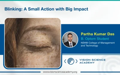 Blinking: A Small Action with Big Impact